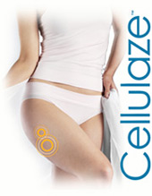 Cellulaze Cellulaze